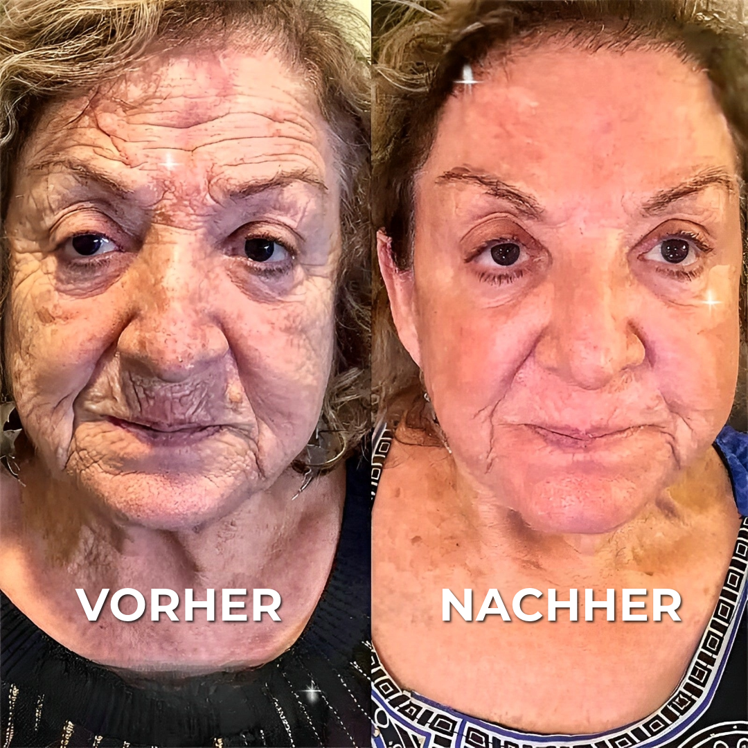 BOTOX™ Anti-Falten-Creme