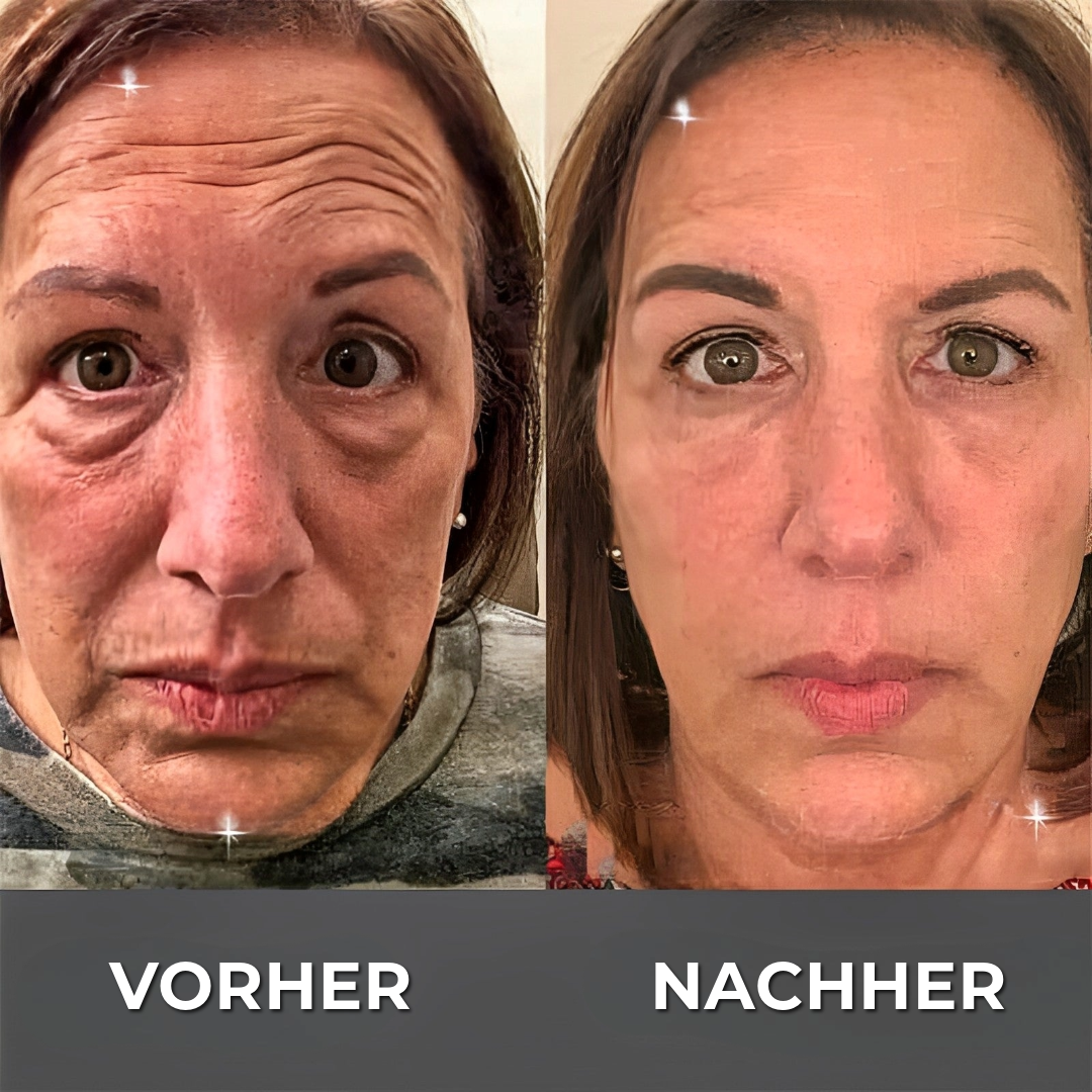 BOTOX™ Anti-Falten-Creme