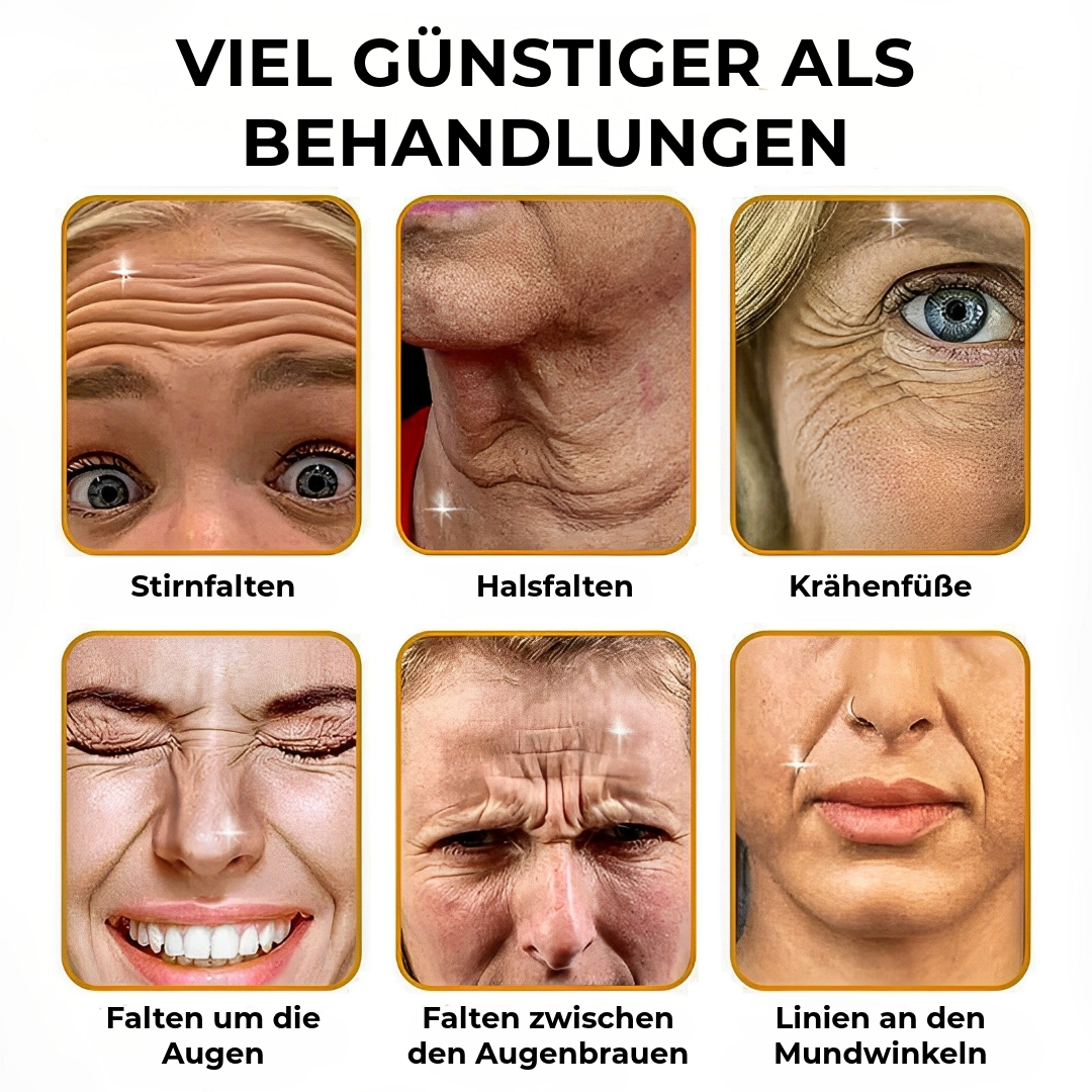 BOTOX™ Anti-Falten-Creme